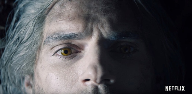 Henry Cavill scratched his eye to the point of almost going blind from wearing contact lenses for too long while filming The Witcher - Photo 3.