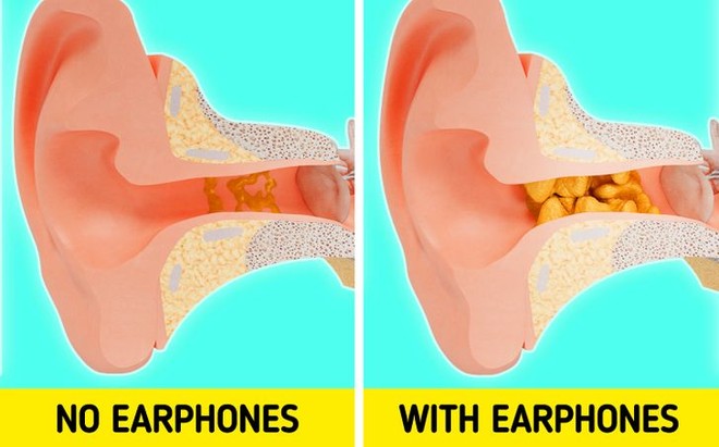 Cảnh báo: Nếu tiếp tục đeo tai nghe lâu, đây sẽ là điều xảy ra với cơ thể bạn - Ảnh 3.