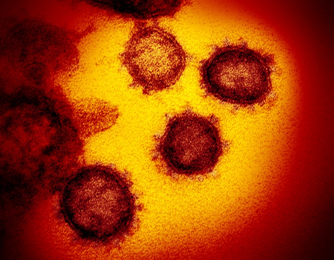 Hình ảnh của virus đáng sợ Covid-19 dưới ống kính hiển vi điện tử - Ảnh 6.