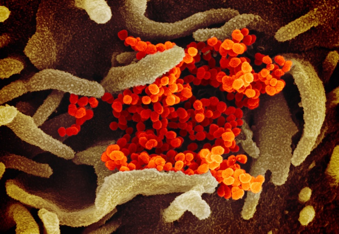 Hình ảnh của virus đáng sợ Covid-19 dưới ống kính hiển vi điện tử - Ảnh 4.
