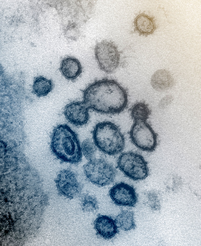 Hình ảnh của virus đáng sợ Covid-19 dưới ống kính hiển vi điện tử - Ảnh 7.