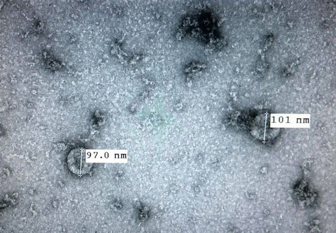Hình ảnh của virus đáng sợ Covid-19 dưới ống kính hiển vi điện tử - Ảnh 1.
