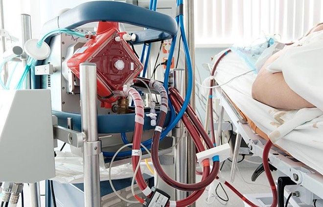 Vietsub: Máy trao đổi oxy qua màng ngoài cơ thể cứu sống bệnh nhân Covid-19 như thế nào? - Ảnh 5.
