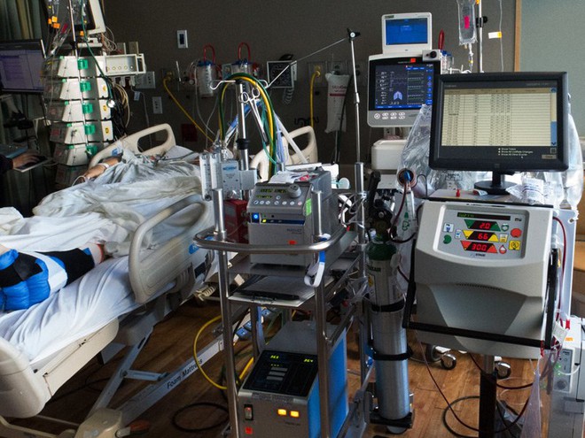 Vietsub: Máy trao đổi oxy qua màng ngoài cơ thể cứu sống bệnh nhân Covid-19 như thế nào? - Ảnh 4.