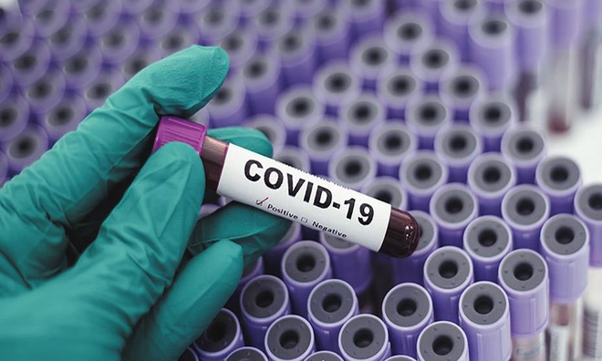 Covid-19 không giống với cúm mùa, nó nguy hiểm gấp hàng chục lần - Ảnh 4.