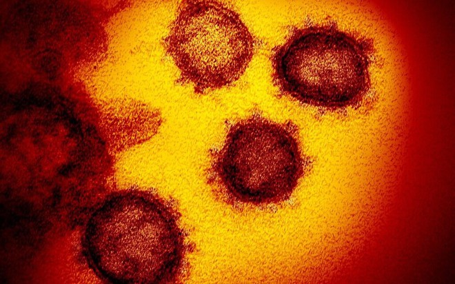 Lý do vì sao virus gây bệnh Covid-19 khó tiêu diệt đến thế: kẻ nằm giữa hóa học và sinh học, sống và không sống - Ảnh 3.