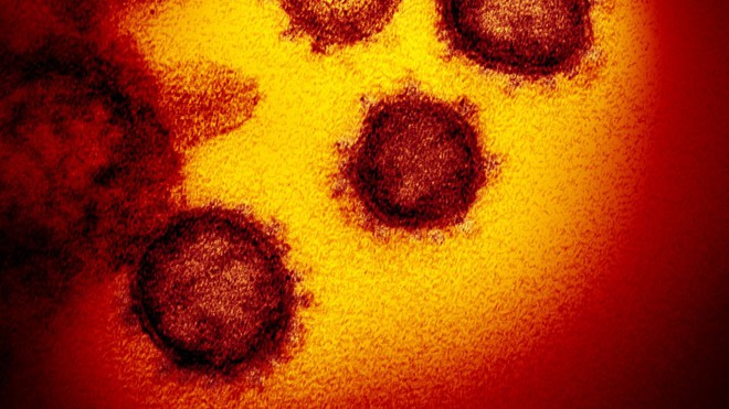 Nhà văn khoa học mô tả tường tận quá trình virus corona lây nhiễm, tấn công người bệnh - Ảnh 11.
