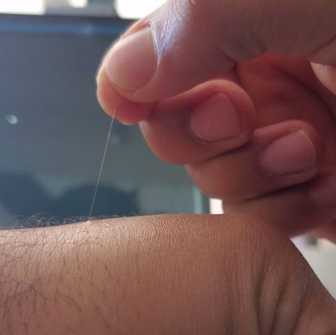 Tại sao một số lông trên cơ thể bạn có thể mọc dài tới mức vô lý - Ảnh 2. Tại sao một số lông trên cơ thể bạn có thể mọc dài tới mức vô lý - Ảnh 2.