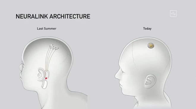 Elon Musk công bố thiết bị Neuralink được thử nghiệm trên heo, với những khả năng tương lai như lưu, tua ký ức và chơi game - Ảnh 2.