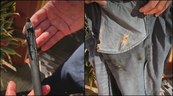 iPhone X ‘phát nổ’ trong túi, người đàn ông ở Úc khởi kiện Apple [HOT]