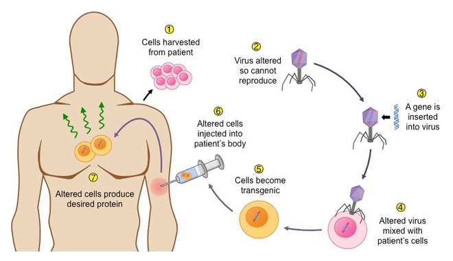 Giữa đại dịch của một virus, một virus đại dịch khác lại đang cứu sống những đứa trẻ bong bóng - Ảnh 7. Giữa đại dịch của một virus, một virus đại dịch khác lại đang cứu sống những đứa trẻ bong bóng - Ảnh 7.
