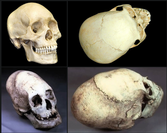 Những hộp sọ kỳ lạ nhất từng được phát hiện trong lịch sử - Ảnh 5.