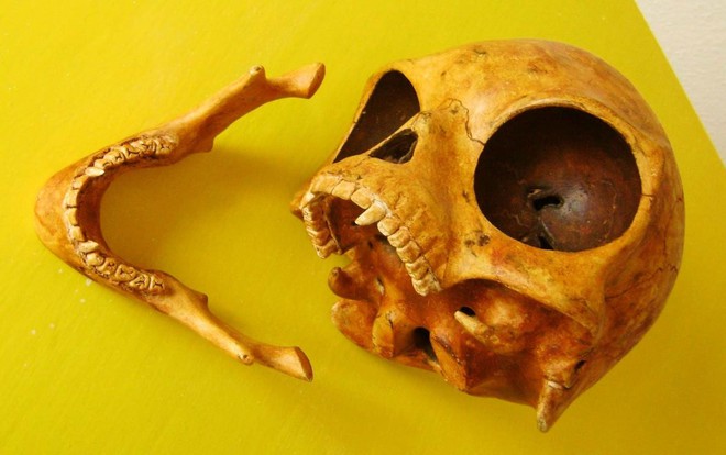 Những hộp sọ kỳ lạ nhất từng được phát hiện trong lịch sử - Ảnh 9.