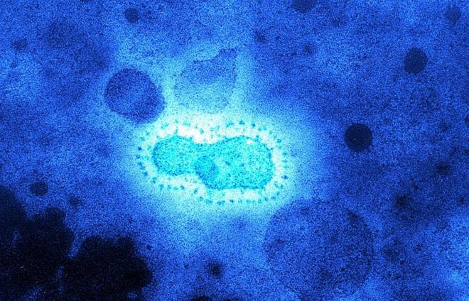 Các nhà khoa học rã băng vĩnh cửu ở Tây Tạng, tìm thấy 28 chủng virus cổ đại chưa từng được biết đến - Ảnh 3.