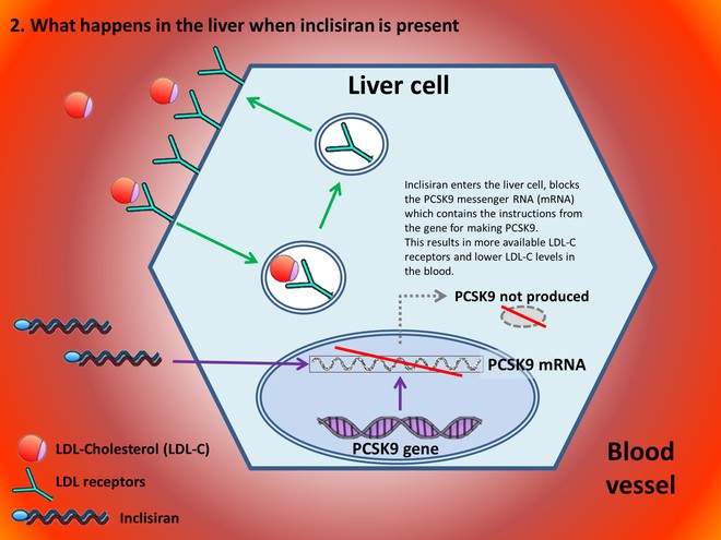Một mũi tiêm RNA có giá hơn 60 triệu, giúp hạ mỡ máu, phòng ngừa đột quỵ vừa được cơ quan y tế Anh chấp thuận - Ảnh 3. Một mũi tiêm RNA có giá hơn 60 triệu, giúp hạ mỡ máu, phòng ngừa đột quỵ vừa được cơ quan y tế Anh chấp thuận - Ảnh 3.