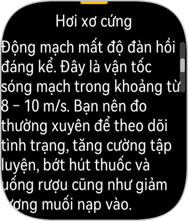 Tôi dùng đồng hồ mới lần đầu tiên ra mắt của Huawei: Quá thực dụng!- Ảnh 21. Tôi dùng đồng hồ mới lần đầu tiên ra mắt của Huawei: Quá thực dụng!- Ảnh 21.