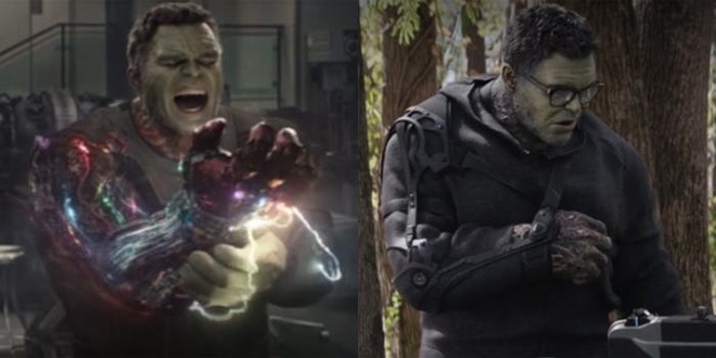 Đáng lẽ Iron Man đã chết đau đớn hơn rất nhiều trong Endgame: Nửa gương mặt biến dạng hoàn toàn chứ không chỉ bỏng sương sương như bản công chiếu - Ảnh 3.