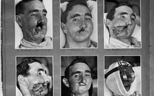 Câu chuyện bi thảm về hàng trăm phi công "chuột lang" trong thế chiến II và vị bác sĩ đã giúp họ tìm lại hình hài con người