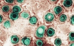 Virus herpes 'tái sinh' ẩn nấp trong não có thể liên quan đến chấn động và sa sút trí tuệ