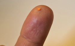 Vật thể chỉ 2mm làm nên điều kỳ diệu, giúp người mù đọc sách trở lại Vật thể chỉ 2mm làm nên điều kỳ diệu, giúp người mù đọc sách trở lại