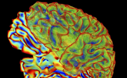 Công nghệ đột phá: Trí tuệ nhân tạo đọc được suy nghĩ con người