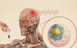 Chip não tiêm của MIT có thể điều trị bệnh mà không cần phẫu thuật