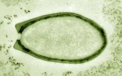 Virus có phải là sinh vật sống không? Tranh cãi kéo dài hàng thập kỷ và những khám phá mới đang thay đổi câu trả lời