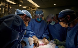 Bệnh nhân ghép thận lợn đầu tiên tại châu Á phải cắt bỏ tạng, quay lại lọc máu