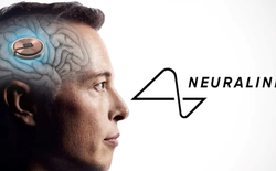 Công ty của Elon Musk cấy chip vào não người chỉ trong 1,5 giây, độ chính xác cực cao giúp tránh các mạch máu nhỏ