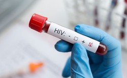 Đi khám sức khỏe định kỳ, nam shipper 35 tuổi phát hiện nhiễm HIV: Choáng váng khi biết nguồn lây