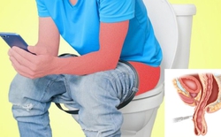 Sa 13 cm ruột ra ngoài vì ngồi toilet ôm điện thoại suốt 2 tiếng