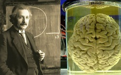 Công nghệ lập bản đồ RNA mới mở ra cơ hội giải mã bộ não Einstein và kho báu di truyền bị lãng quên