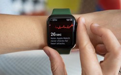 Nghiên cứu: Apple Watch phát hiện sớm nguy cơ đột quỵ tốt hơn cả khám định kỳ