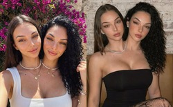 Cú lừa ngoạn mục của kỷ nguyên số: Cặp song sinh dính liền "vạn người mê" này thực chất là sản phẩm của AI