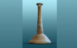 Có thể bạn chưa biết, vào thời La Mã người ta đã sử dụng phân người làm thuốc