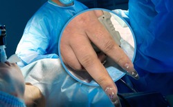 Ca cấp cứu kỳ lạ ở Trung Quốc: Bác sĩ bất lực, bệnh viện buộc gọi thợ làm móng vào phòng cấp cứu gấp