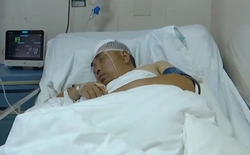 Người đàn ông mắc 3 bệnh ung thư cùng lúc vì thói quen "giải tỏa căng thẳng" rất quen với nam giới Việt