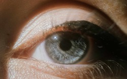 Đến năm 2050, một nửa dân số thế giới sẽ bị cận thị!