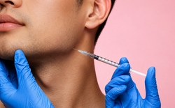"Executie": Khi các sếp nam trốn nhân viên đi tiêm filler, tinh trùng cá hồi lên mặt để trông tươi tắn uy quyền nhất có thể