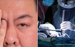 Tin vào mẹo dân gian trên mạng để giải xui khi nháy mắt phải, người đàn ông suýt mù vĩnh viễn vì bị bong võng mạc