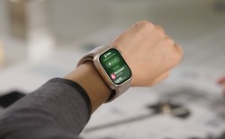 Ra mắt "máy đo huyến áp" có màn hình Huawei mới: Dây đeo dãn nở, đo liên tục cả ngày, giá gần 14 triệu