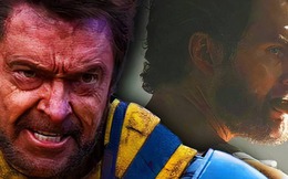 “Người Sói” Hugh Jackman hé lộ cái tên phù hợp nhất cho vai trò Wolverine kế nhiệm