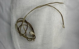 Dây sạc điện thoại nằm trong bàng quang của nam sinh sau khi học theo clip trên mạng