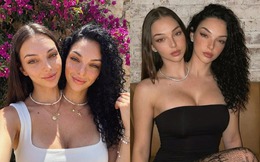 Cú lừa ngoạn mục của kỷ nguyên số: Cặp song sinh dính liền "vạn người mê" này thực chất là sản phẩm của AI