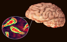 Rất có thể bạn đã bị nhiễm một loại virus ăn não mà bạn chưa từng nghe đến
