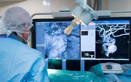Robot can thiệp mạch máu của Trung Quốc đạt 100% thành công, rút ngắn gần một phần ba thời gian phẫu thuật não