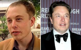 Bệnh hói đầu sắp ”tuyệt chủng” đến nơi: Huyết thanh từ thực vật giúp tóc dày lên 25% chỉ trong 56 ngày