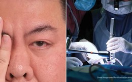 Tin vào mẹo dân gian trên mạng để giải xui khi nháy mắt phải, người đàn ông suýt mù vĩnh viễn vì bị bong võng mạc