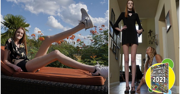 [Video] Cuộc sống của cô gái có đôi chân dài nhất thế giới