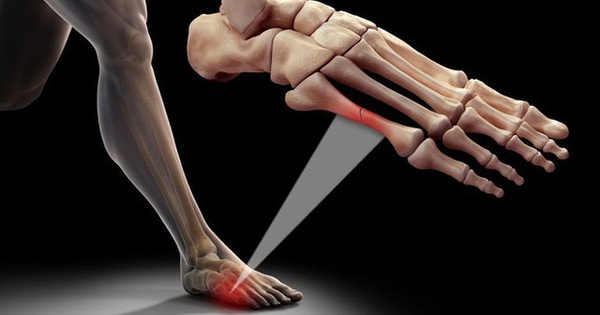 Why do Asians only have 204 bones while Europeans and Americans have 206?  It turns out that the remaining 2 puzzle pieces disappeared for this reason